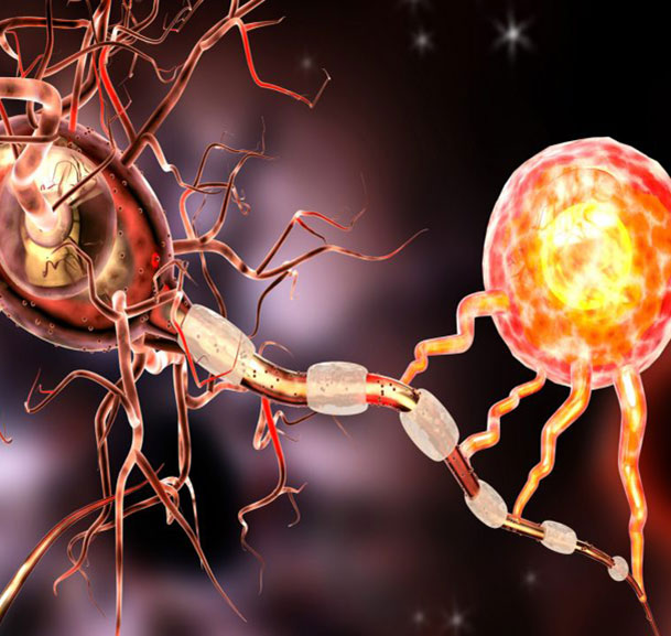 Nova uloga lipida u multiploj sklerozi